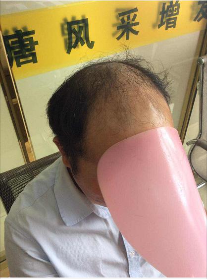 沒有對(duì)比就沒有傷害，唐風(fēng)采假發(fā)品質(zhì)看得見！
