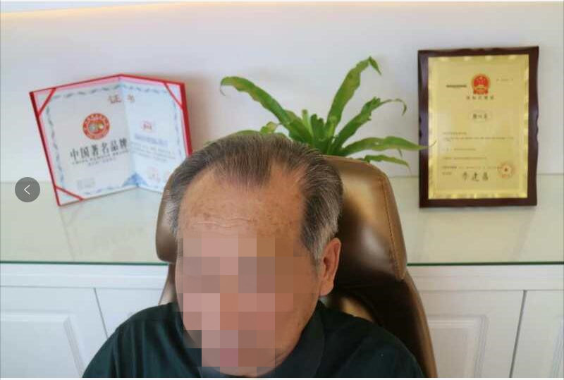 “大爺”秒變“萌叔”？唐風(fēng)采假發(fā)為您保守年齡的秘密！