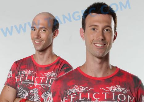 肌肉男多光頭？警惕激素脫發(fā)問題！