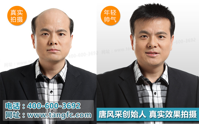 奧尼爾戴白發(fā)開(kāi)懟，小伙伴們千萬(wàn)別模仿！