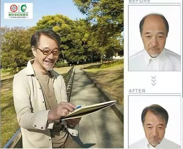 來自NASA的黑科技生發(fā)頭盔，禿頂有救了？