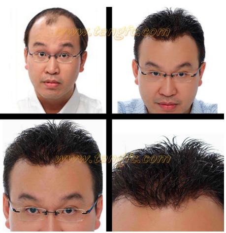 來自NASA的黑科技生發(fā)頭盔，禿頂有救了？