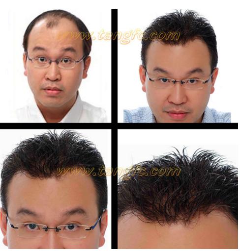 哪家假發(fā)適合脫發(fā)人？金華哪里有假發(fā)專賣店？