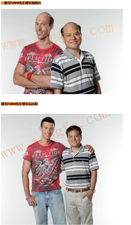 貝克漢姆的中年危機，脫發(fā)繞過誰？