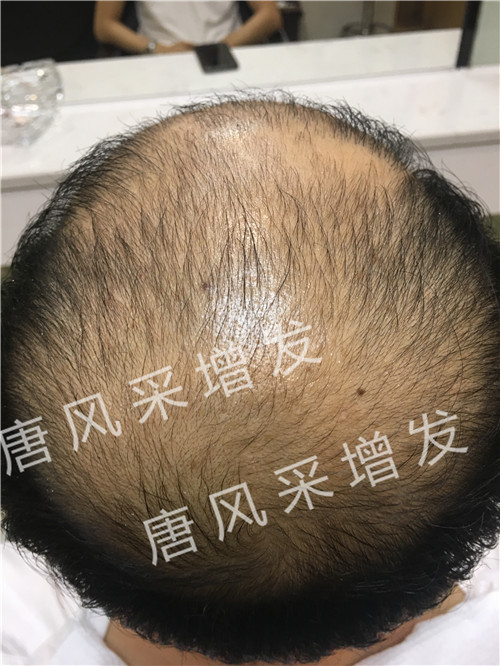 今天咱不看廣告宣傳了，唐風采真實效果，上圖上視頻