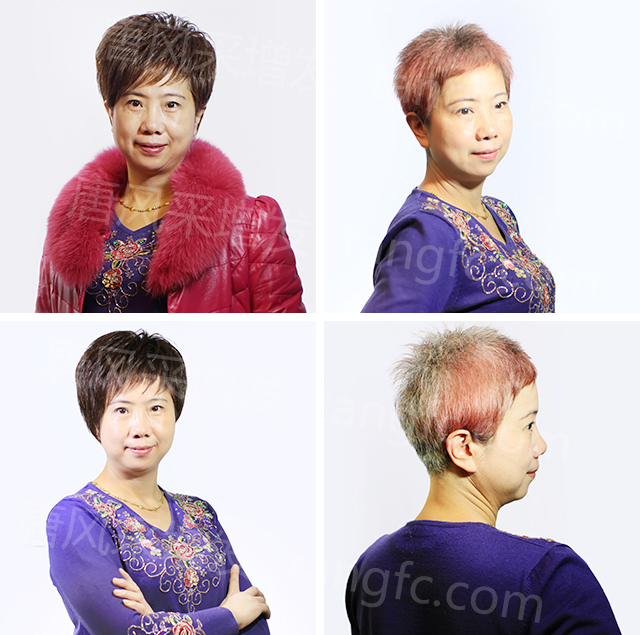 柳州織發(fā)假發(fā)訂做，效果杠杠不負(fù)好時(shí)光！