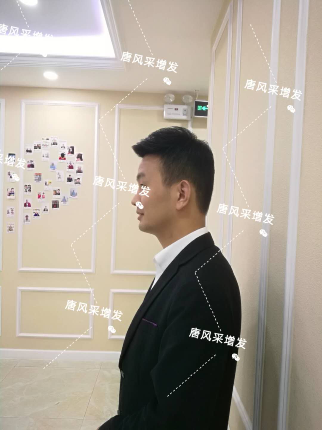 輸了頭發(fā)不能輸氣質(zhì)，看帥哥的逆襲之路！