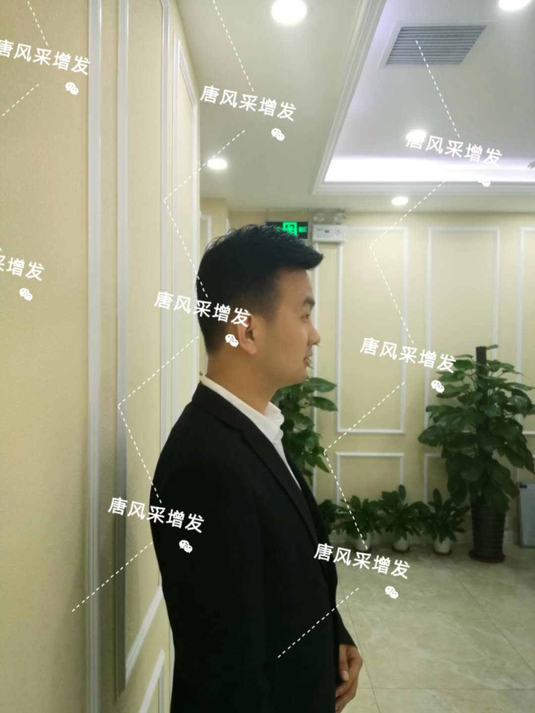 輸了頭發(fā)不能輸氣質(zhì)，看帥哥的逆襲之路！