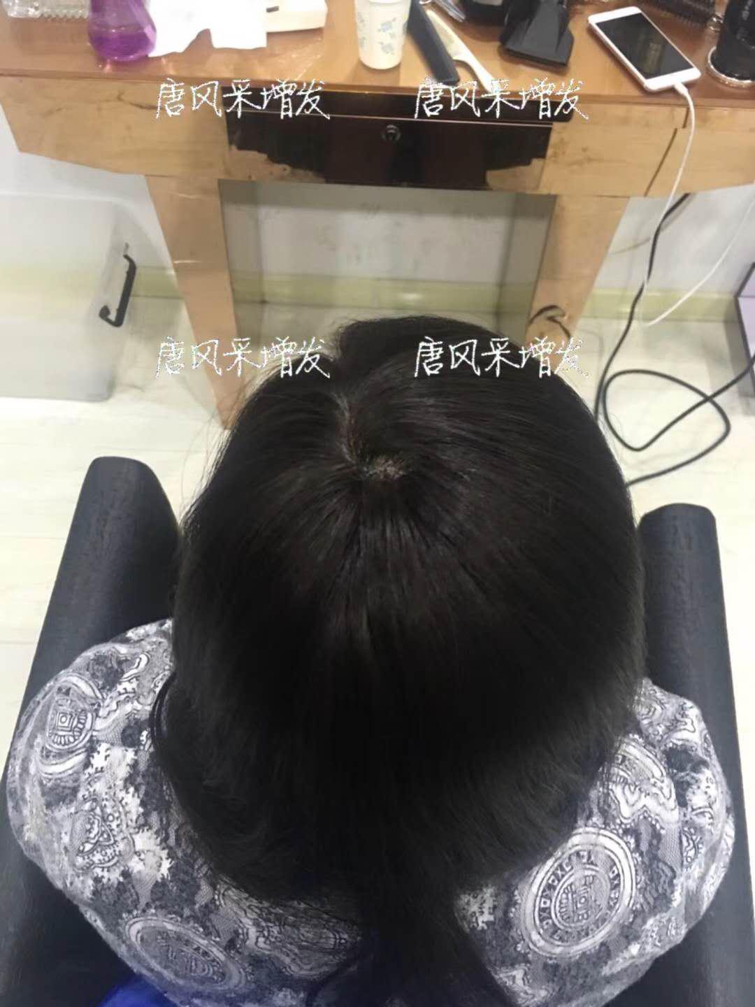 生發(fā)了這么久，但凡有效果的也該有些跡象了