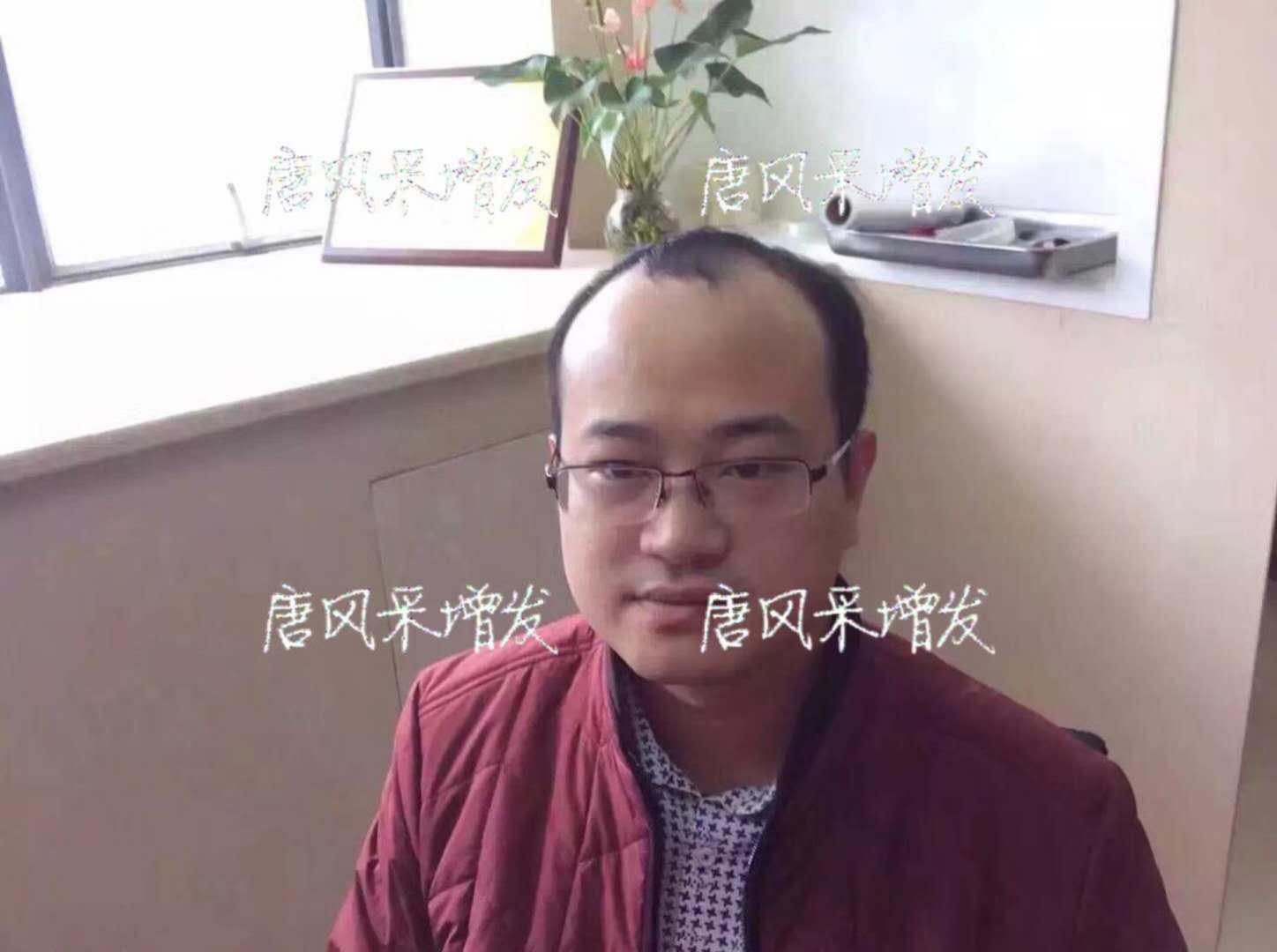  生發(fā)了這么久，但凡有效果的也該有些跡象了