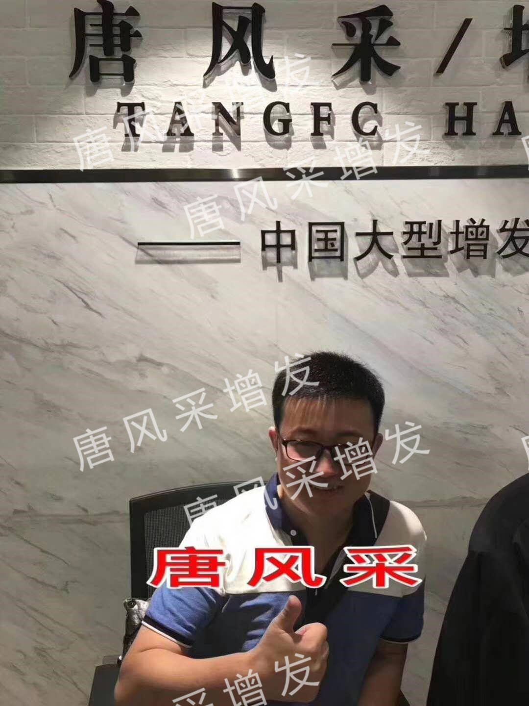 貧窮限制了想象，禿頂限制了造型？