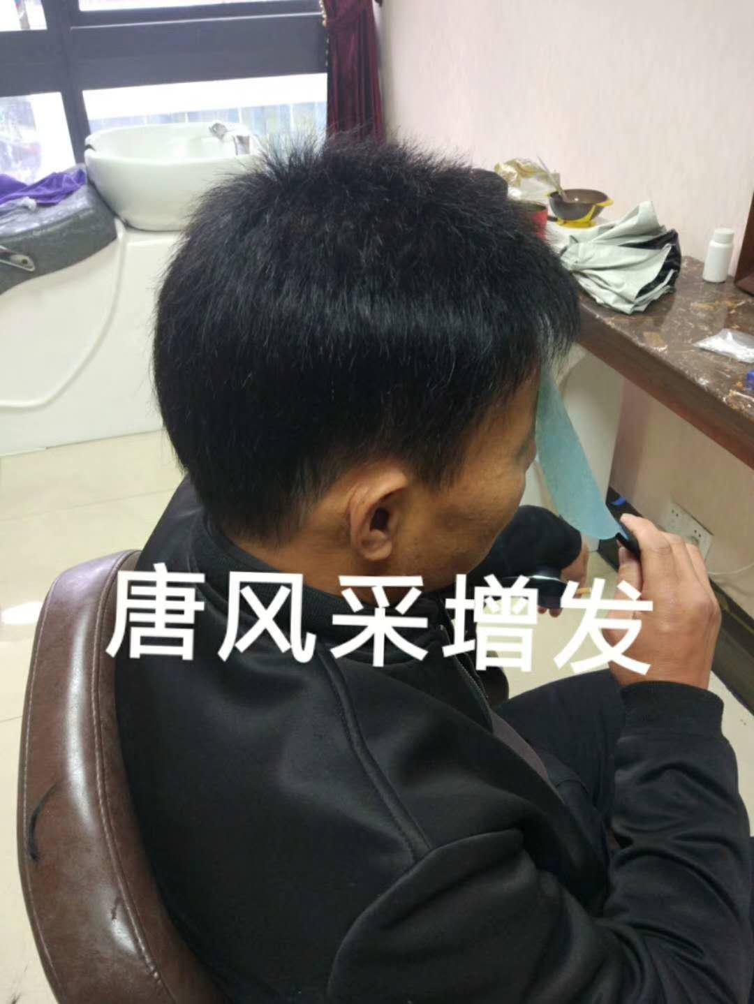 脫發(fā)謝頂壓力大，增發(fā)補發(fā)一身輕！