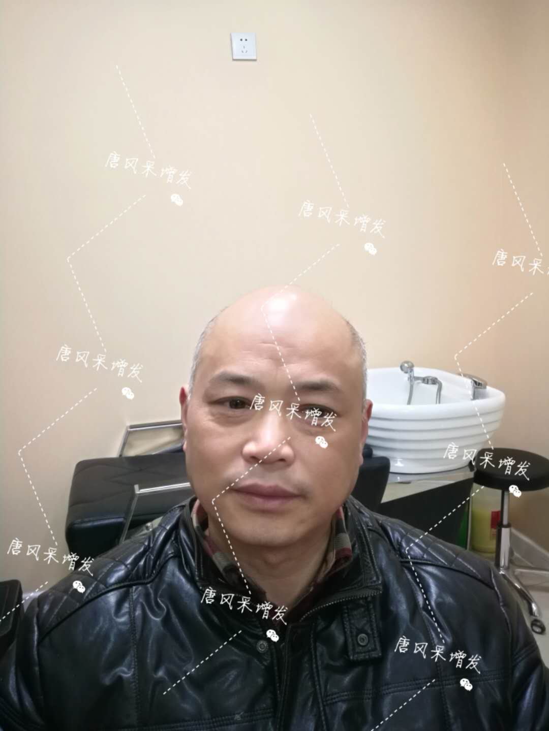 我的天吶！沒想到某防脫洗發(fā)水的老板居然也脫發(fā)了！