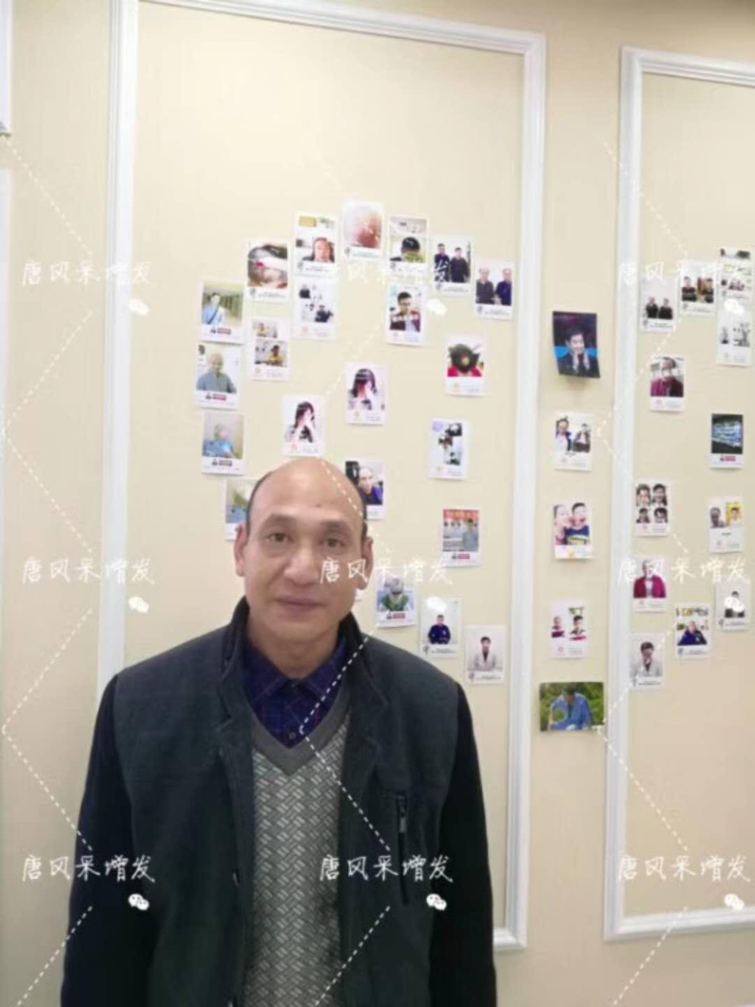 我的天吶！沒想到某防脫洗發(fā)水的老板居然也脫發(fā)了！