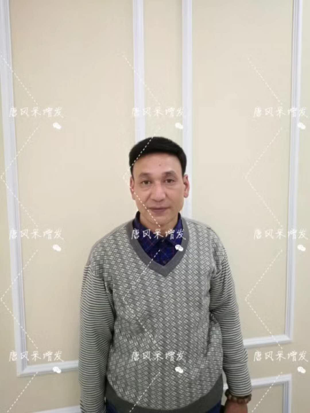 我的天吶！沒想到某防脫洗發(fā)水的老板居然也脫發(fā)了！