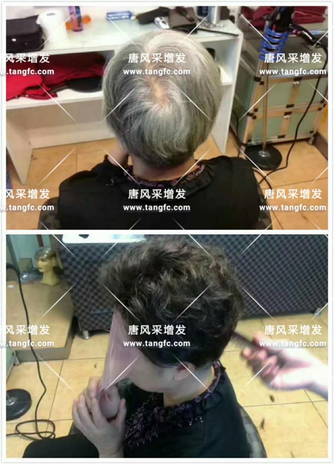 為脫發(fā)者解千愁，增發(fā)前后的驚人對比！