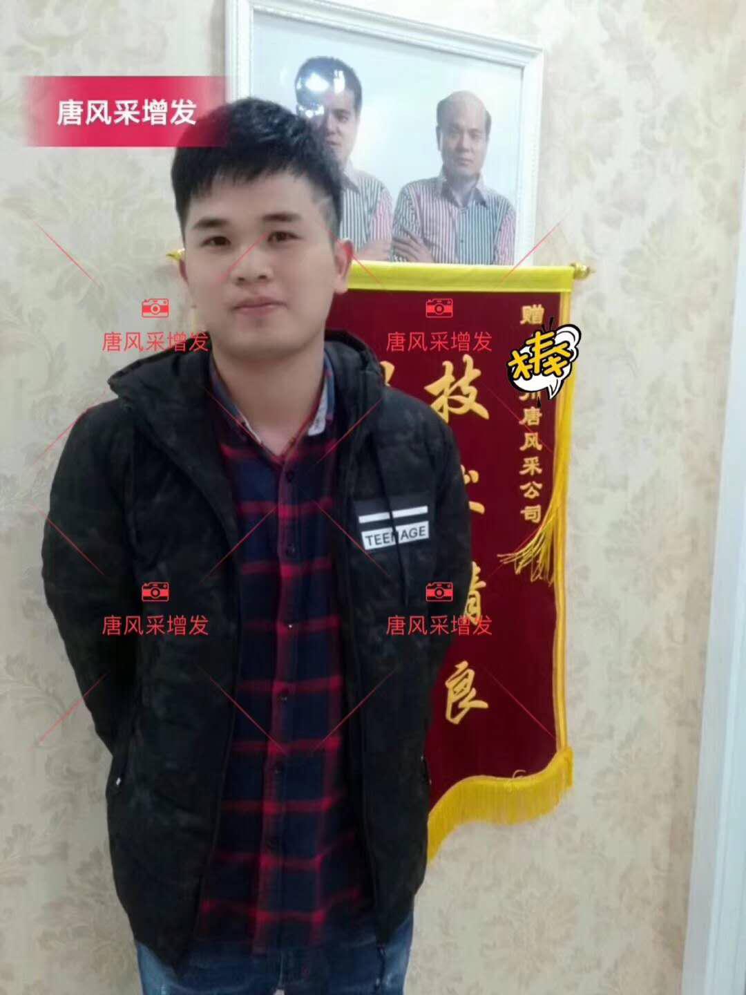 為脫發(fā)者解千愁，增發(fā)前后的驚人對比！