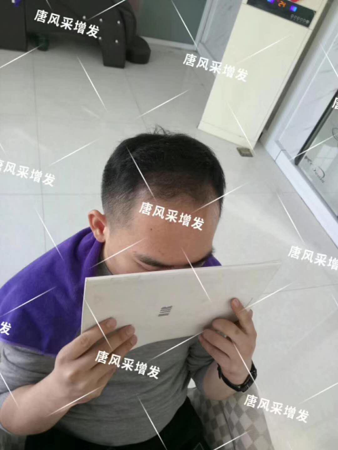 感覺(jué)自尊心好受打擊，朋友說(shuō)我“頭上的油都?jí)虺幢P菜了...