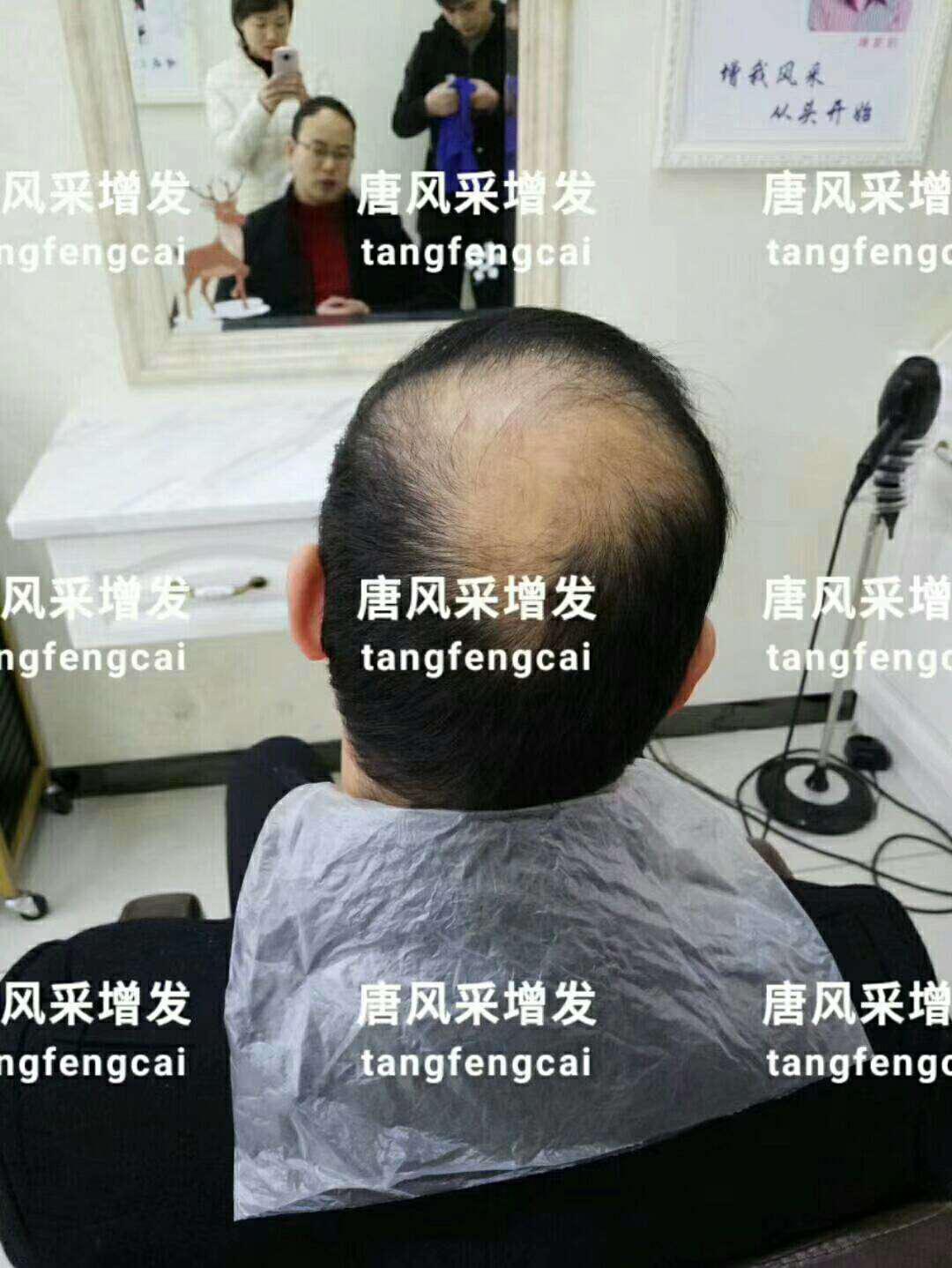  一轉(zhuǎn)眼年輕十歲，你差的就是這點(diǎn)點(diǎn)頭發(fā)！