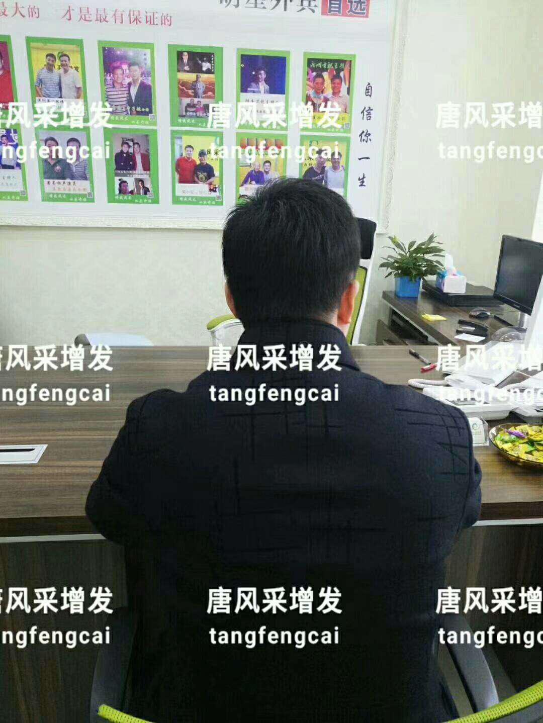  一轉(zhuǎn)眼年輕十歲，你差的就是這點(diǎn)點(diǎn)頭發(fā)！