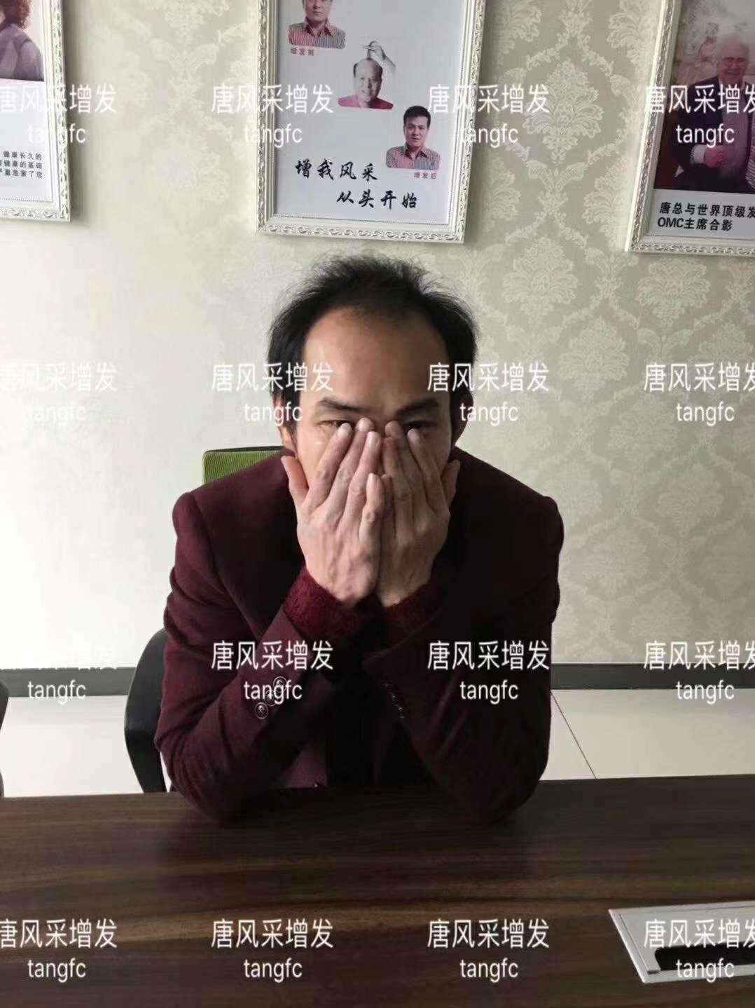 一轉(zhuǎn)眼年輕十歲，你差的就是這點(diǎn)點(diǎn)頭發(fā)！