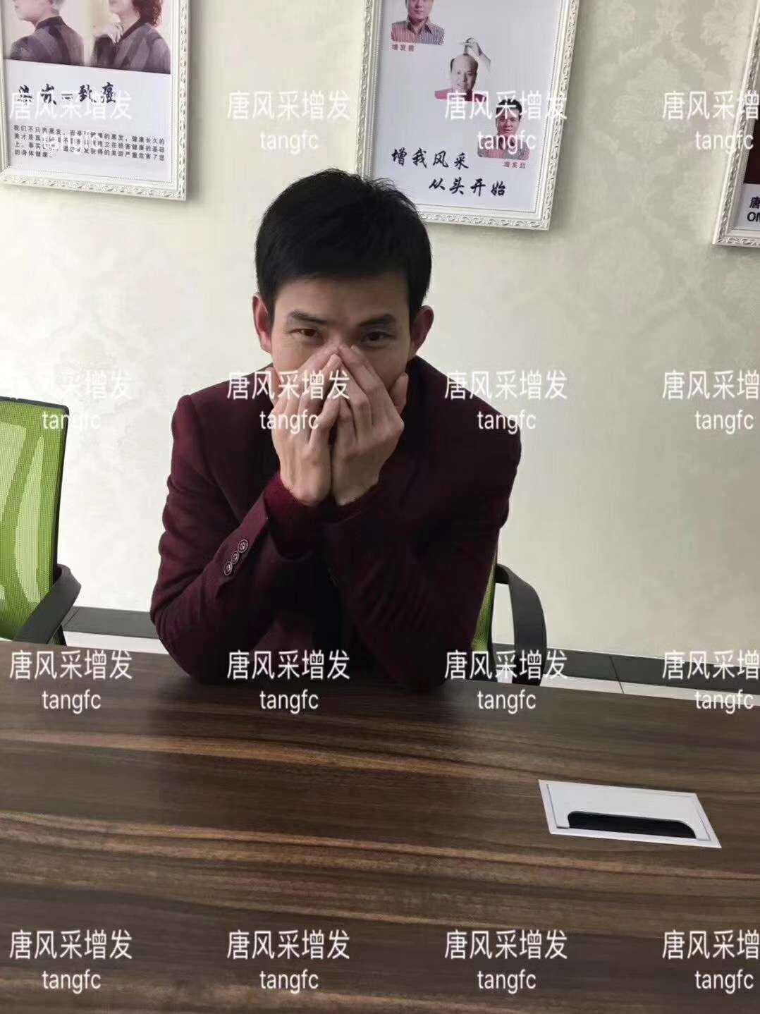  一轉(zhuǎn)眼年輕十歲，你差的就是這點(diǎn)點(diǎn)頭發(fā)！