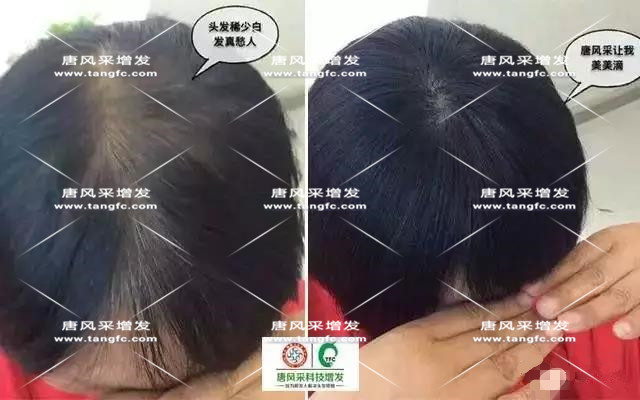 女士假發(fā)見證華麗轉(zhuǎn)變，前后差別震撼！