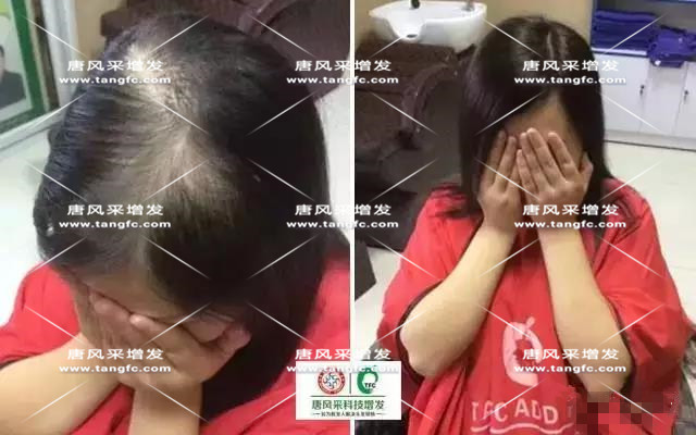 女士假發(fā)見證華麗轉(zhuǎn)變，前后差別震撼！