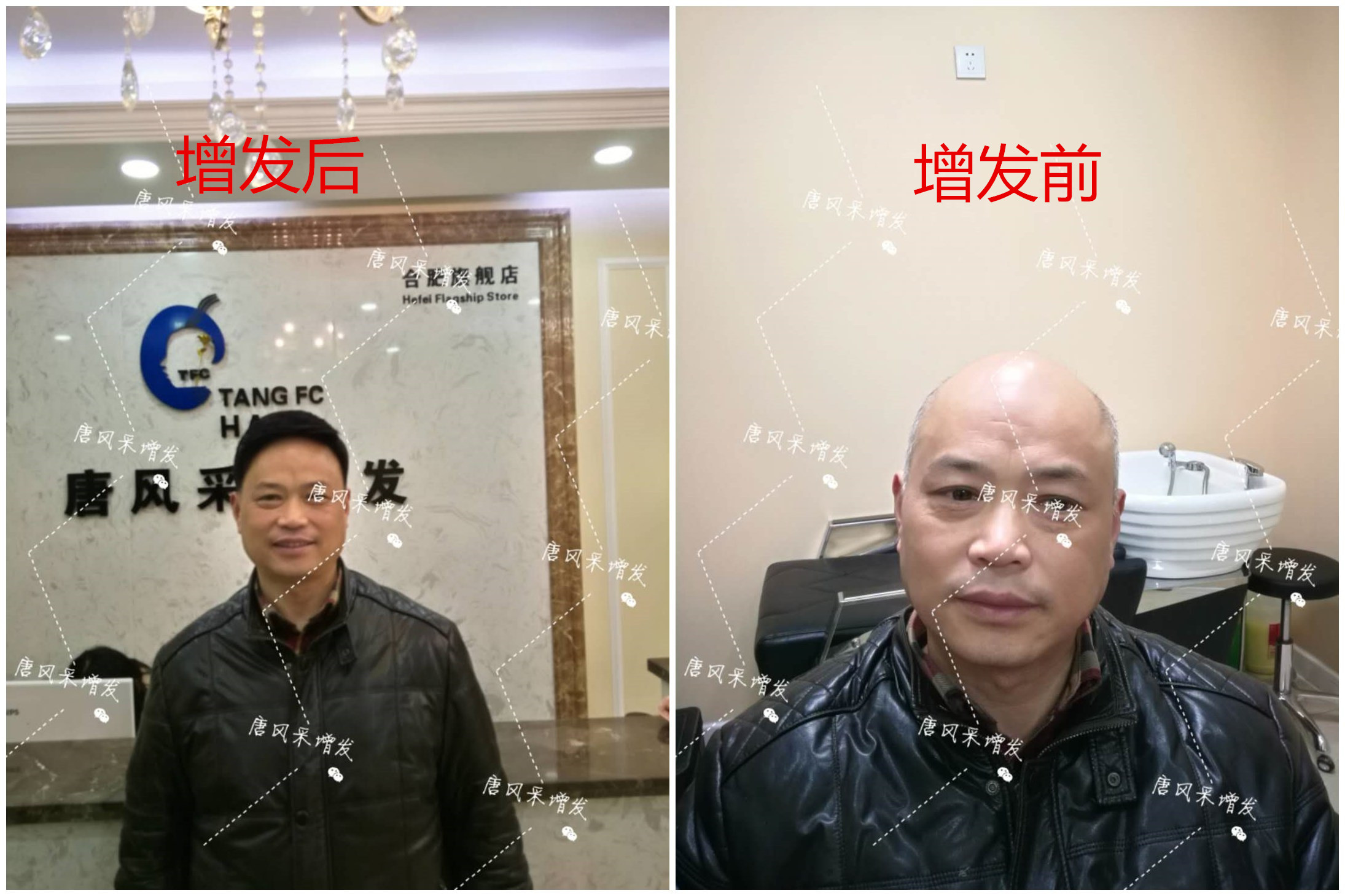 我想知道，在唐風(fēng)采假發(fā)之后，真實客戶是如何評價的？