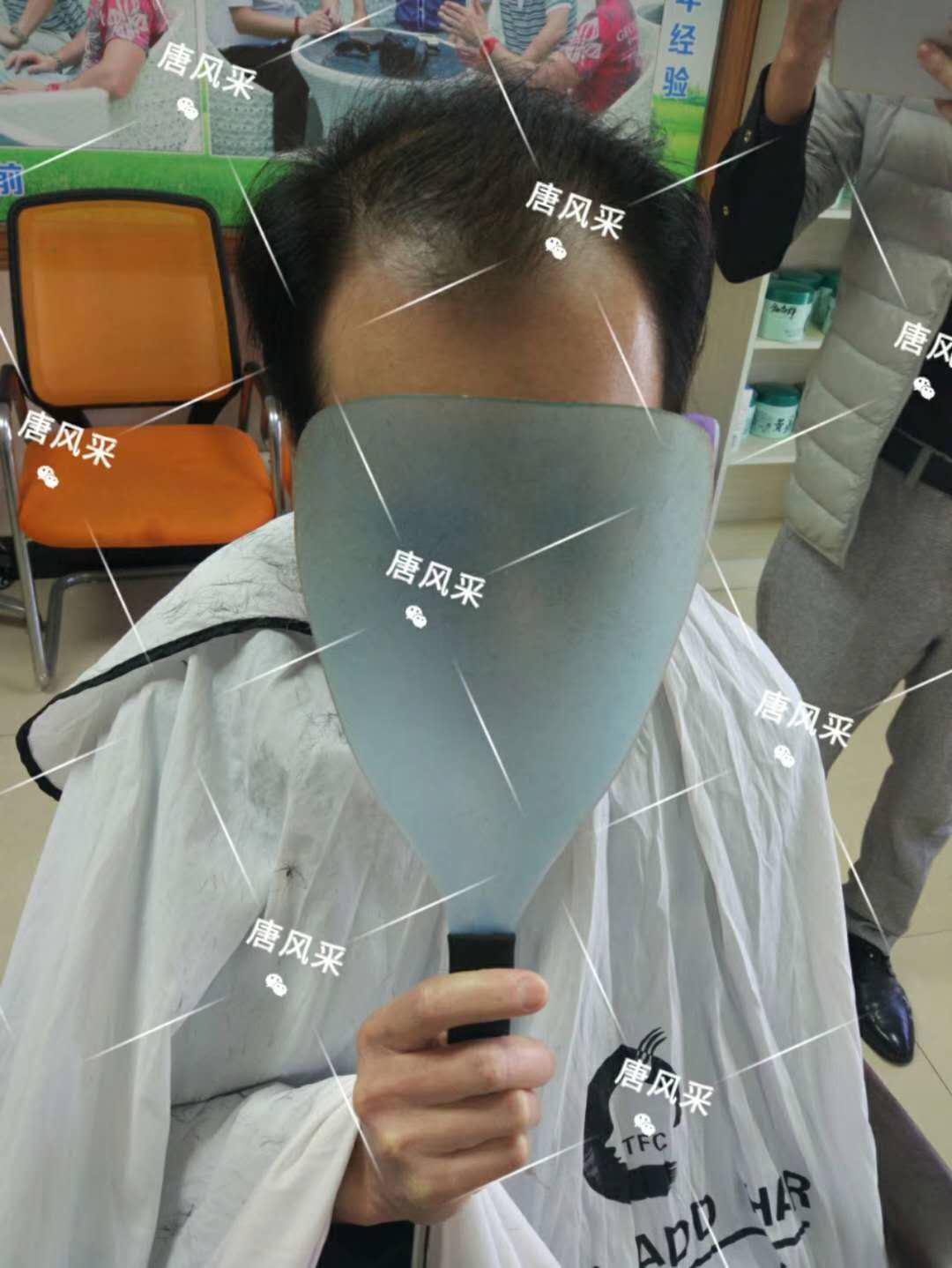 頭發(fā)一洗一大把，猝死不是當(dāng)代年輕人最擔(dān)憂的問題，而是
