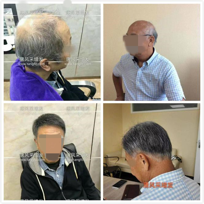 男老人假發(fā)超薄設(shè)計(jì)，這樣的逼真效果你絕對沒見過！