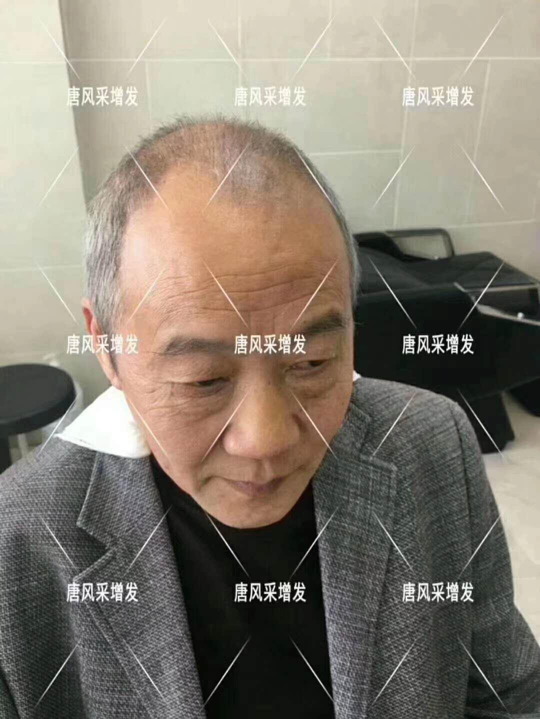 常按這個(gè)穴位好處多多 有助睡眠還能減少白頭發(fā)！