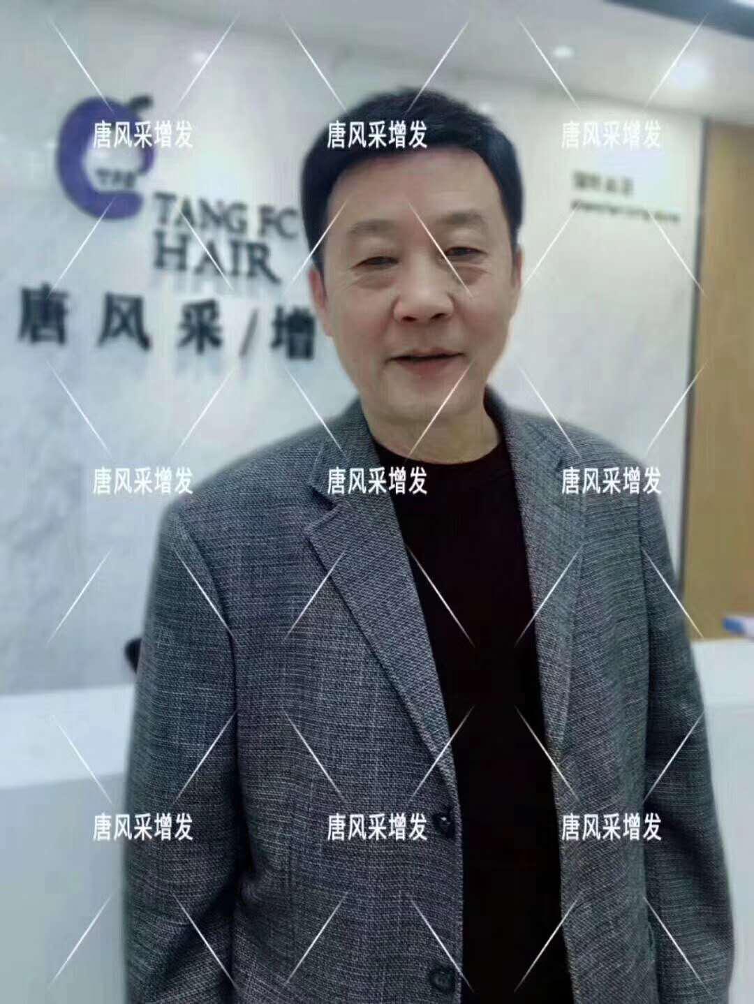 常按這個(gè)穴位好處多多 有助睡眠還能減少白頭發(fā)！