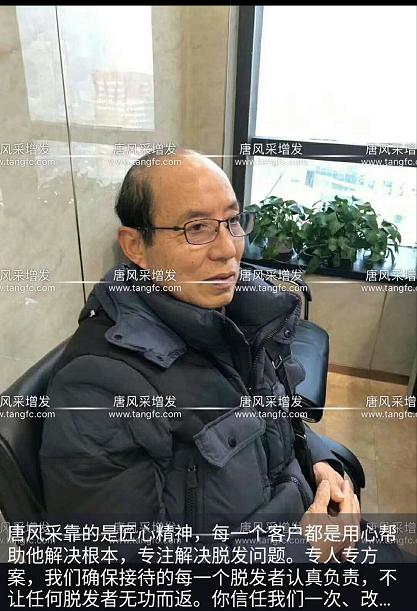大爺大叔傻傻分不清楚？——唐風(fēng)采假發(fā)案例展示