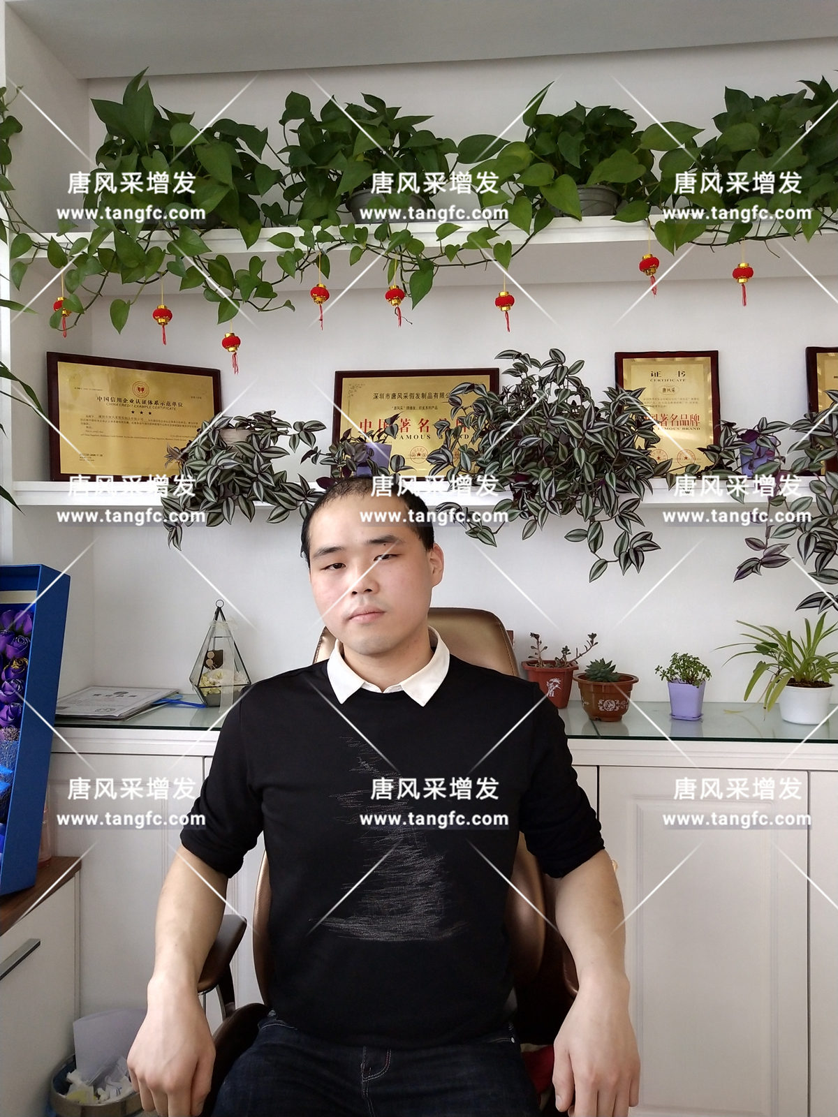 增發(fā)還是植發(fā)，這是個問題！