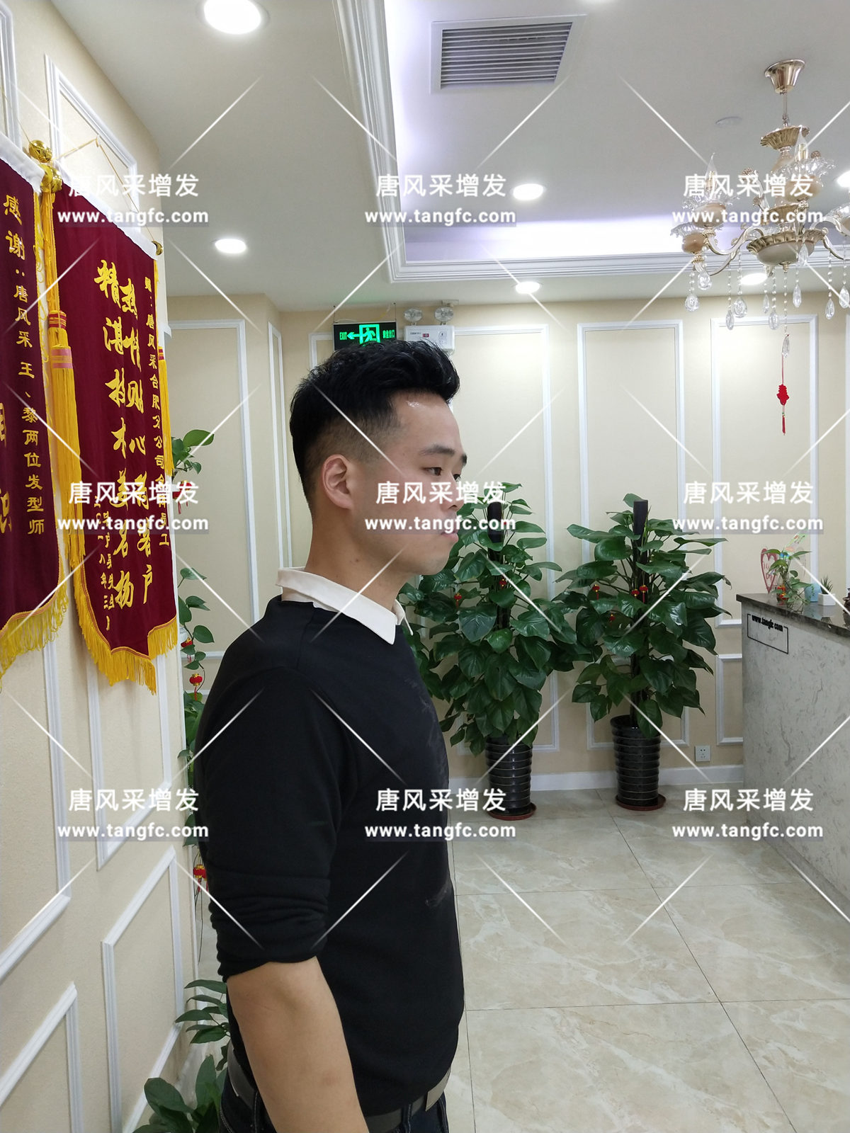 增發(fā)還是植發(fā)，這是個問題！