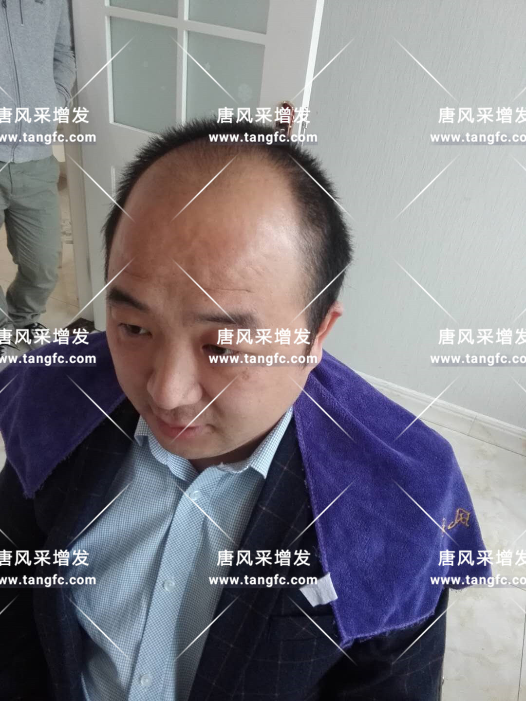 將“脫發(fā)男”變成“型男”模樣，唐風(fēng)采可以做到！