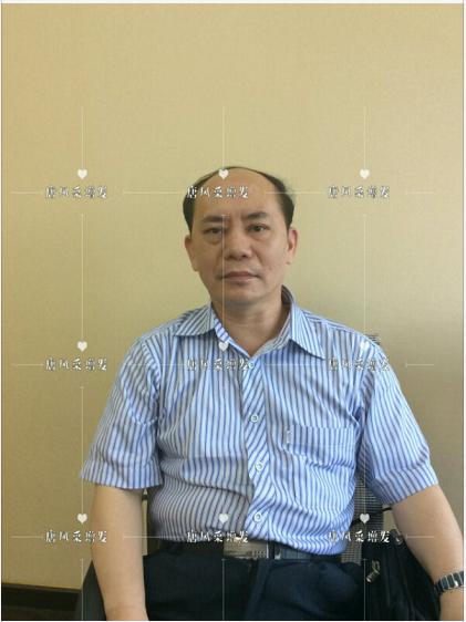 存款重要還是頭發(fā)重要？聽聽李先生怎么說！