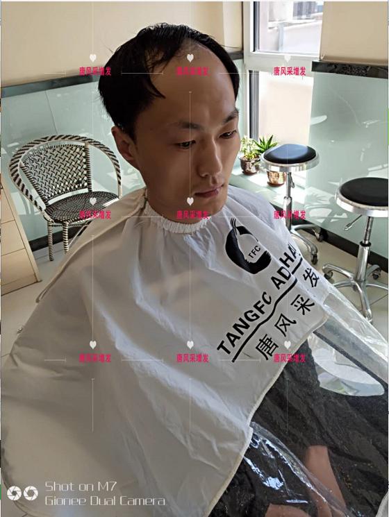 好形象擁抱新生活，唐風(fēng)采助力脫發(fā)新青年！