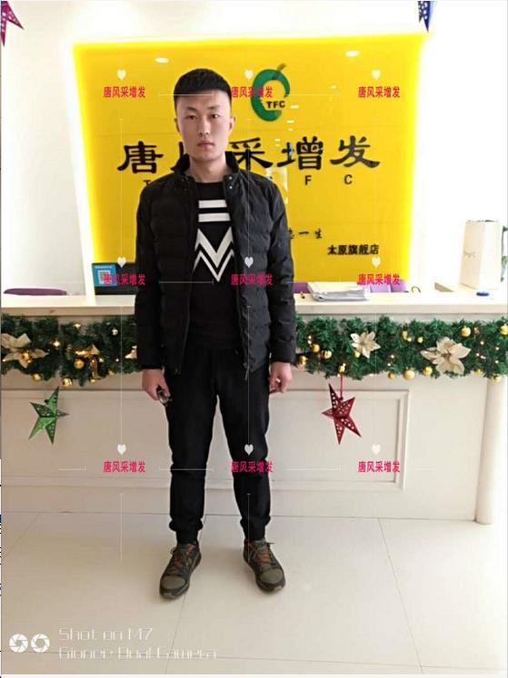 好形象擁抱新生活，唐風(fēng)采助力脫發(fā)新青年！