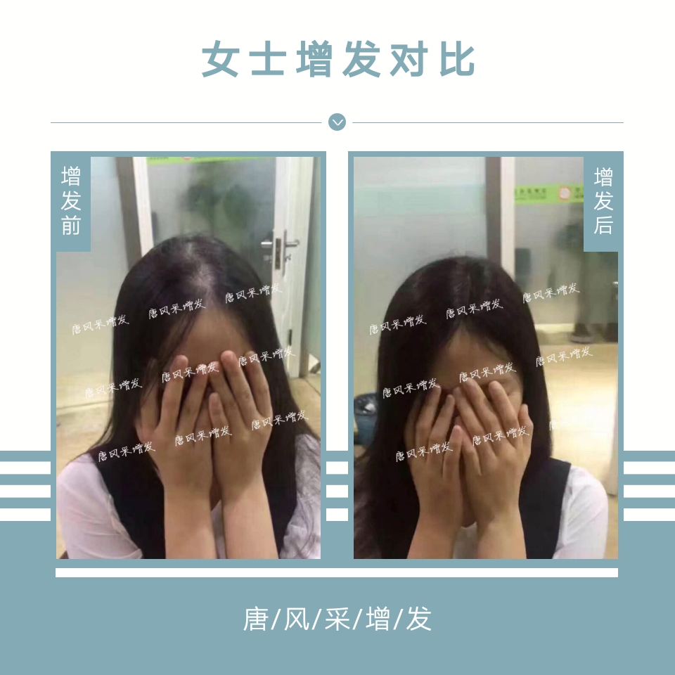 母親節(jié)：我能想到最美好的事，就是把媽媽的青春留住！