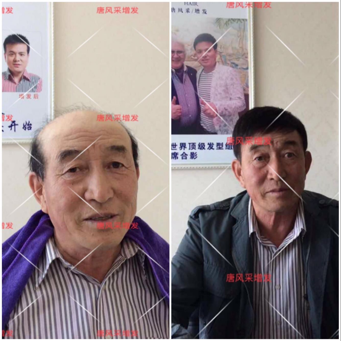 朝陽(yáng)耿直大叔2年內(nèi)苦尋三次唐風(fēng)采假發(fā)，2018終于不虛此行