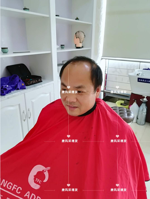 脫發(fā)不分地域，唐風(fēng)采假發(fā)助力北京爺們