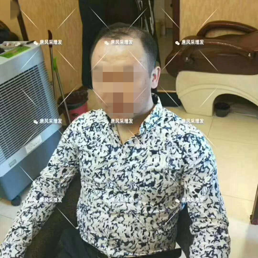 春夏季最新帥氣發(fā)型，頭發(fā)再少也能hold??！