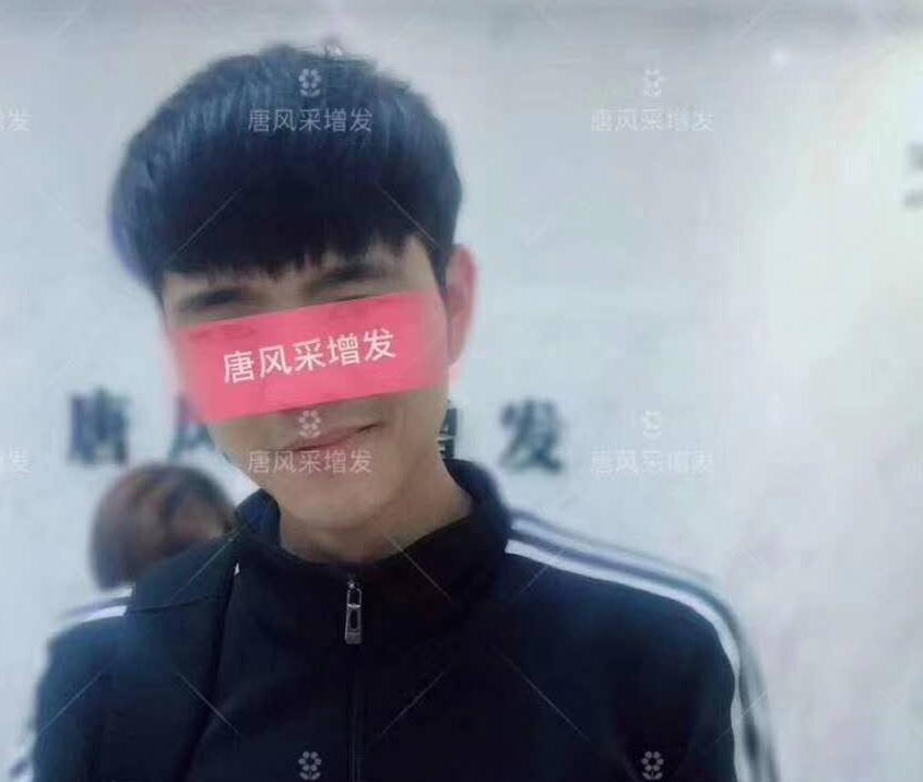 春夏季最新帥氣發(fā)型，頭發(fā)再少也能hold??！