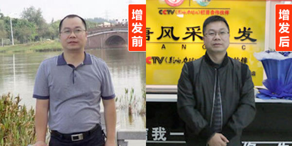 稀發(fā)不哭！終于知道頭發(fā)稀疏可以這樣做。