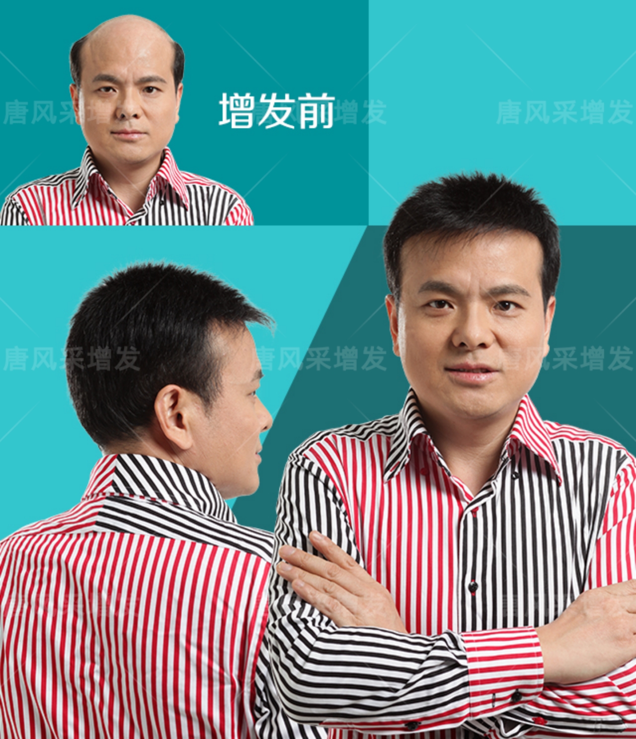 稀發(fā)不哭！終于知道頭發(fā)稀疏可以這樣做！