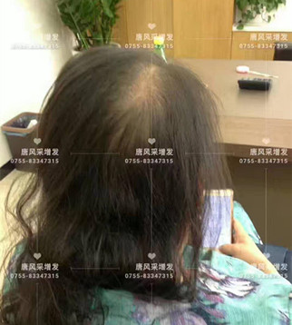 讓頭發(fā)一直好好的，唐風采就是這般任性！