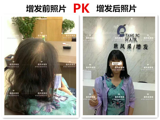 頭發(fā)稀少也能擁有一頭好發(fā)型，不信請看！