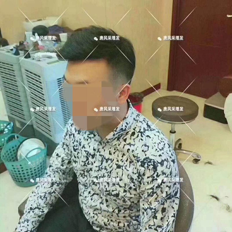 臺州真發(fā)假發(fā)哪有賣，夏天戴假發(fā)會悶熱嗎？